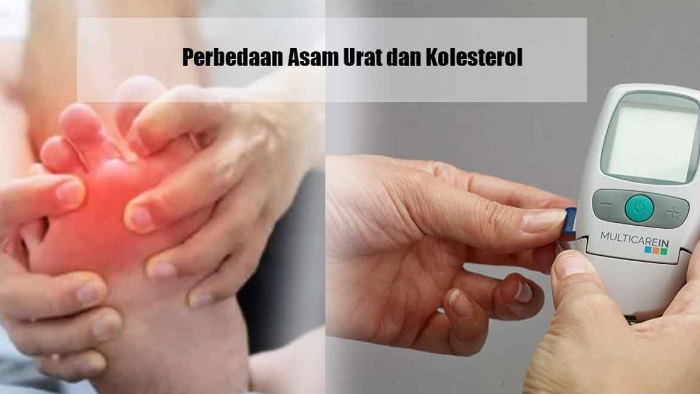 Kolesterol dan Asam Urat, Apa Bedanya? Ini yang Perlu Anda Tahu